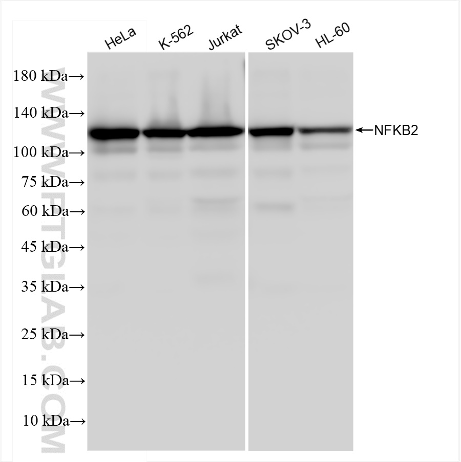 WB analysis using 84022-6-RR (same clone as 84022-6-PBS)