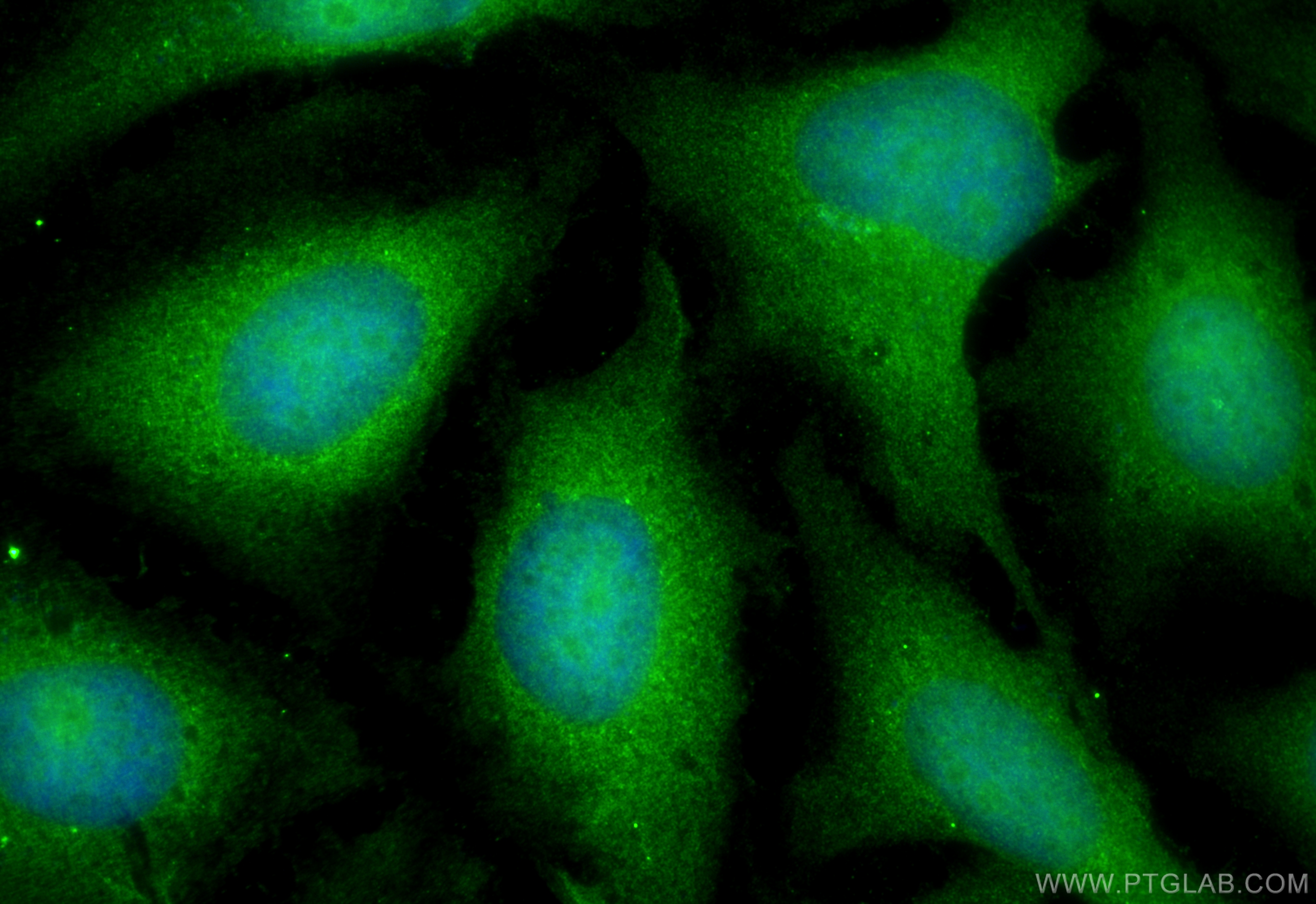 IF Staining of HeLa using 10268-1-AP