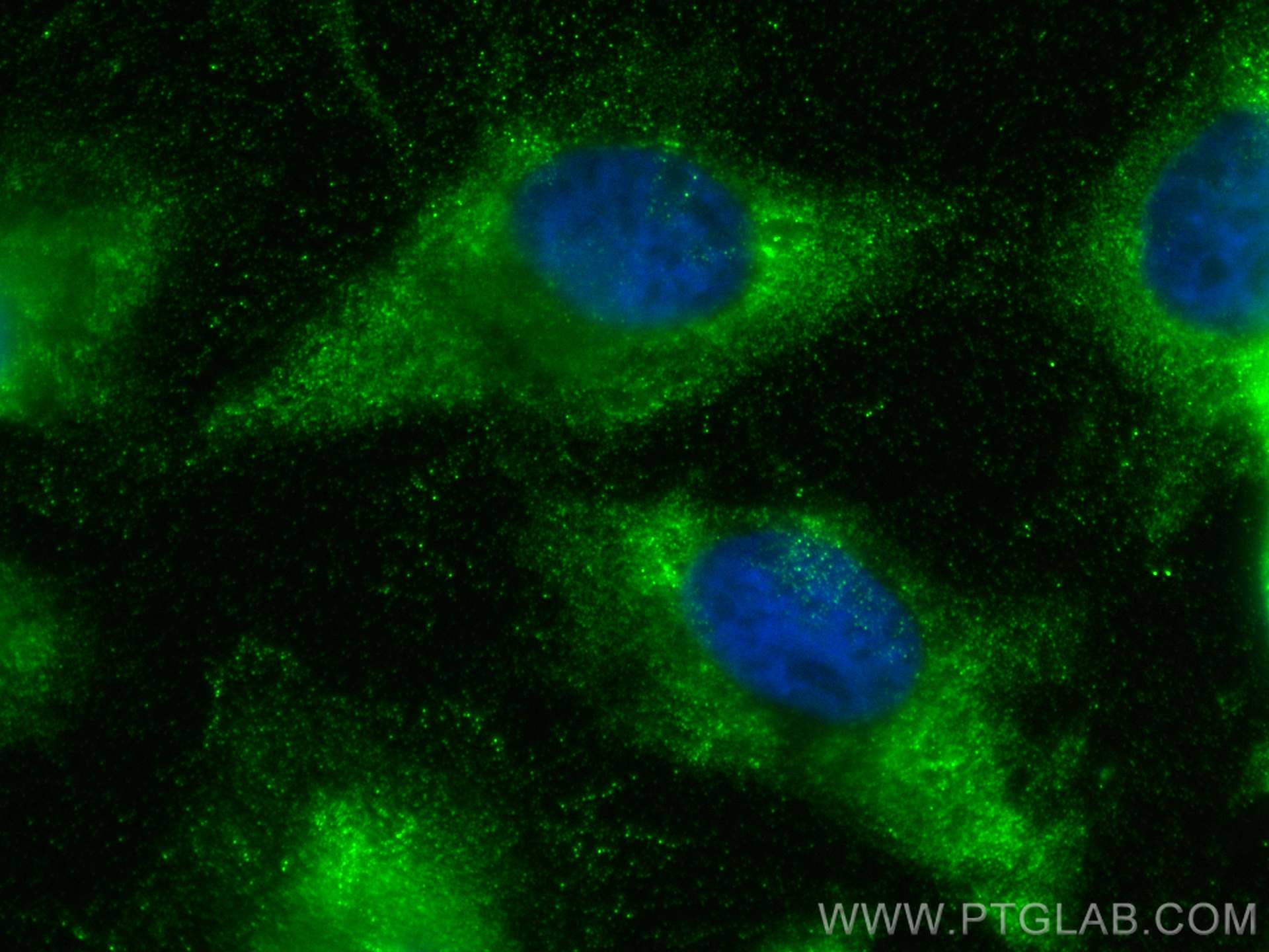 IF Staining of HeLa using 18220-1-AP