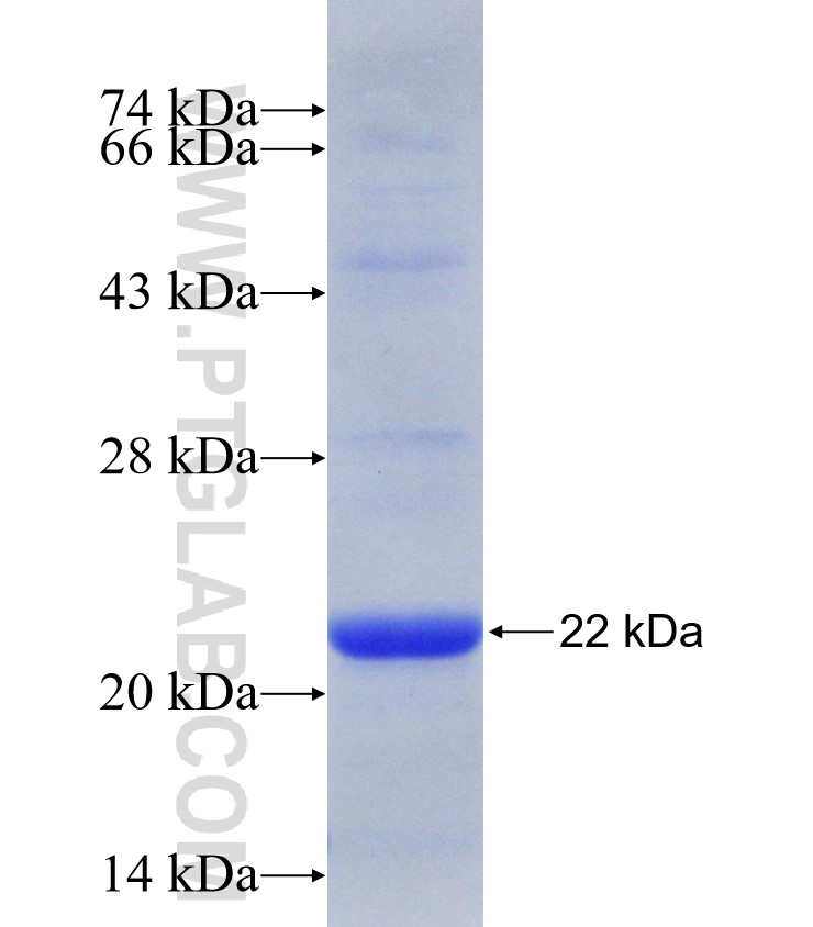 NFKBIZ fusion protein Ag30538 SDS-PAGE