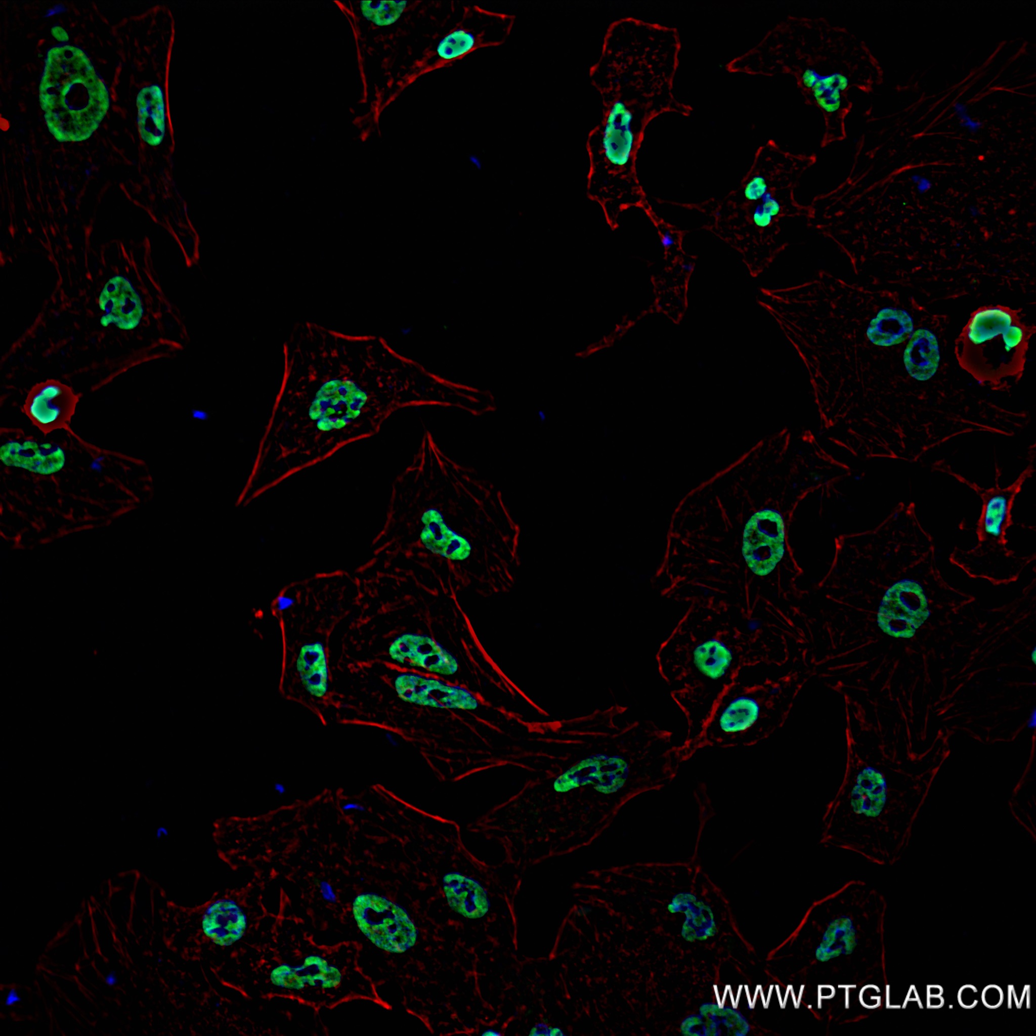 IF Staining of HeLa using 82924-1-RR