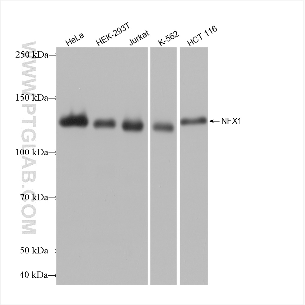 WB analysis using 82924-2-RR (same clone as 82924-2-PBS)