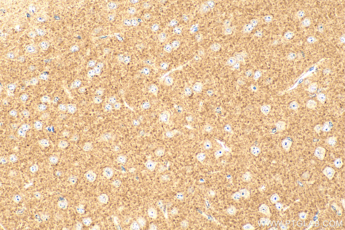 IHC staining of mouse brain using 55014-1-AP