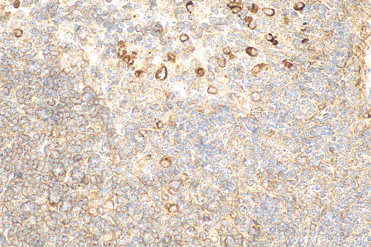 IHC staining of mouse spleen using 55014-1-AP