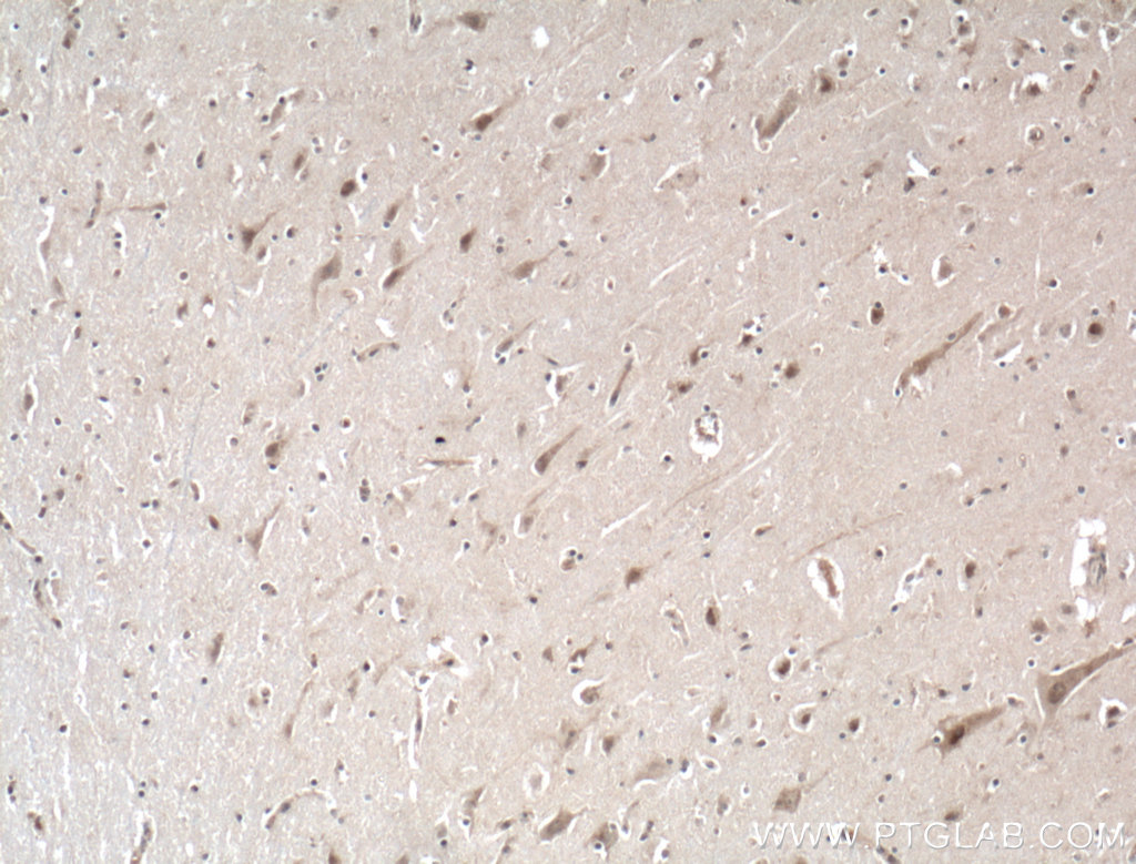 IHC staining of human brain using 14885-1-AP