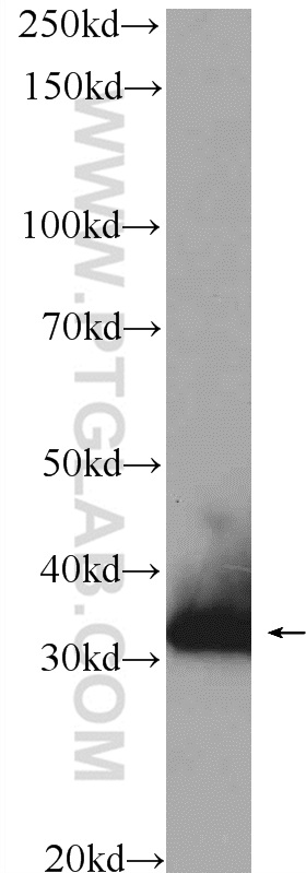 WB analysis of mouse liver using 14885-1-AP