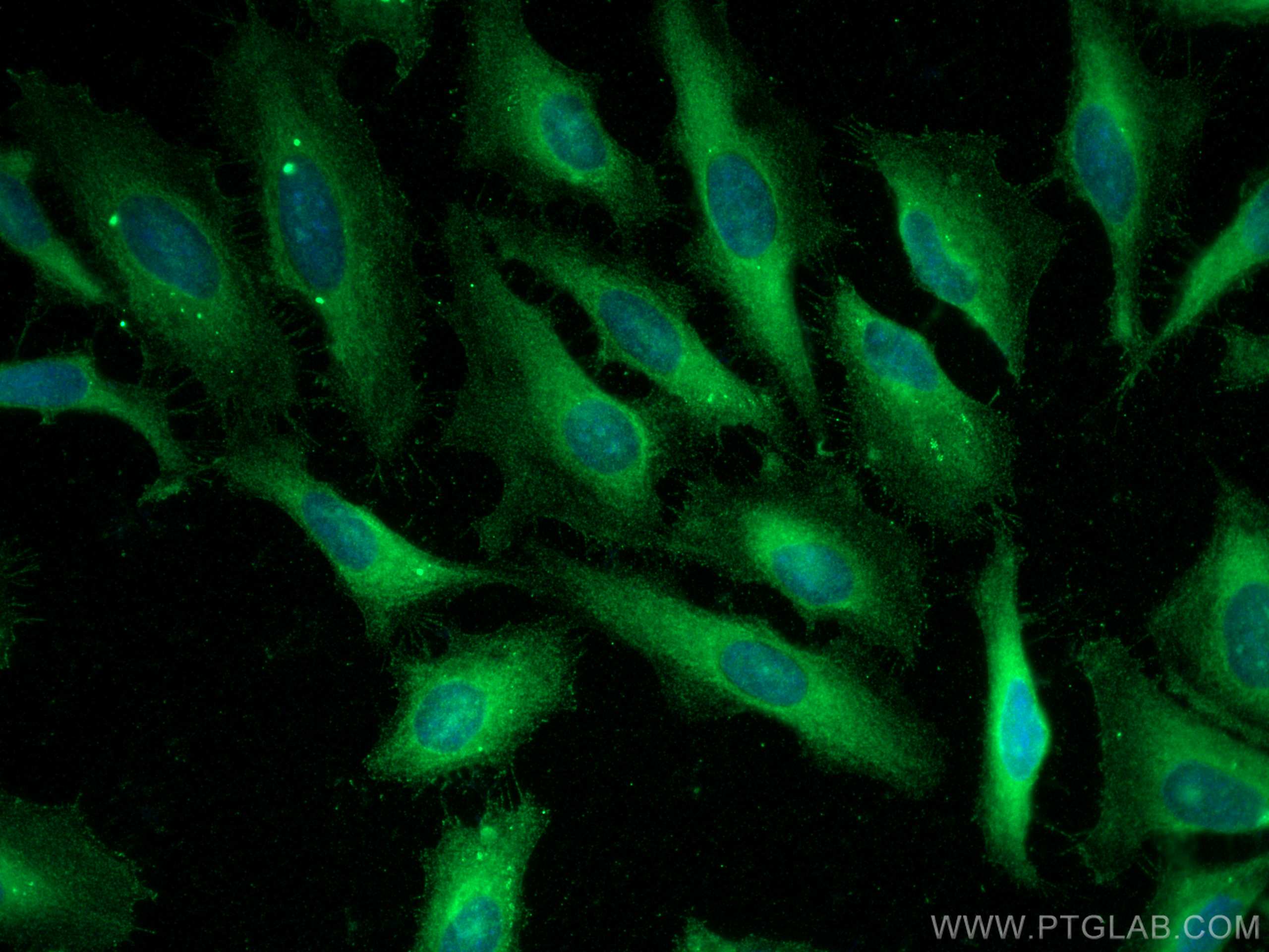 IF Staining of HeLa using 29761-1-AP