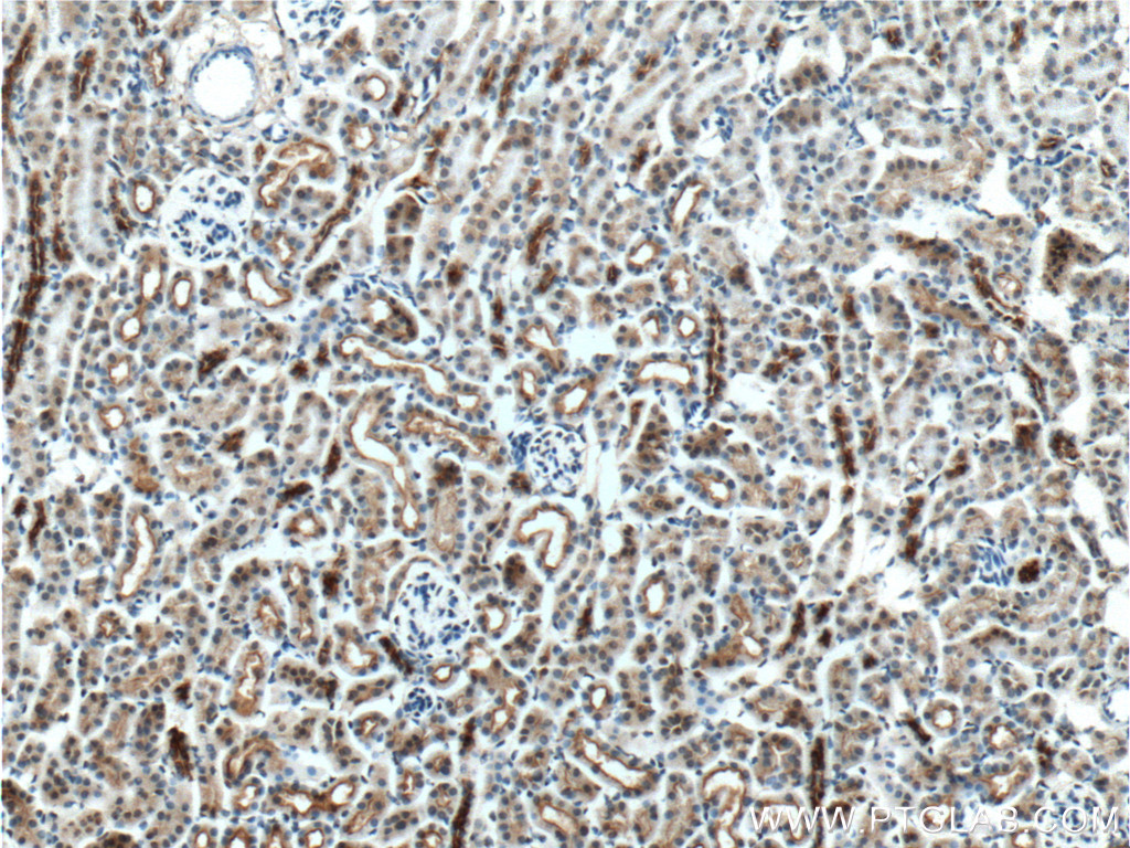 IHC staining of mouse kidney using 27190-1-AP