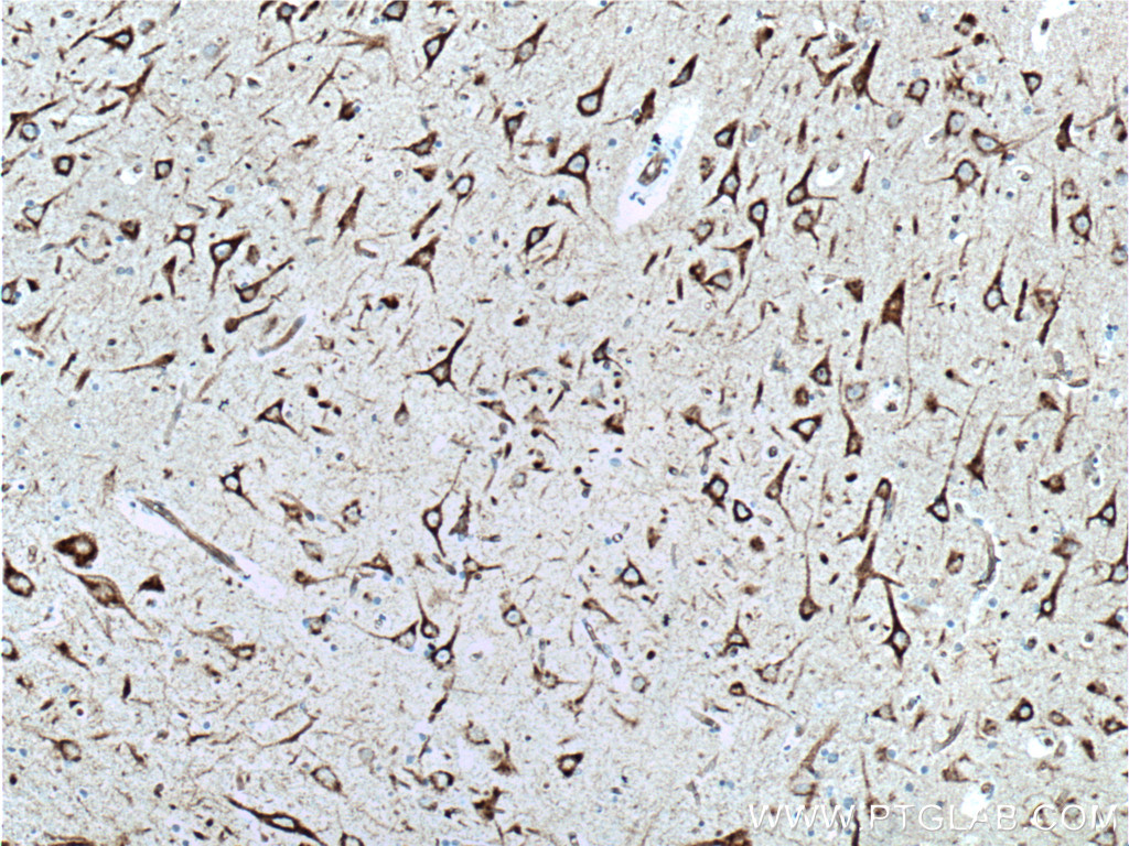 IHC staining of human brain using 24065-1-AP