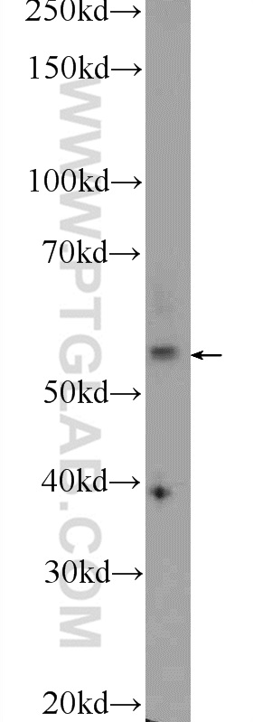 WB analysis of human plasma using 24065-1-AP