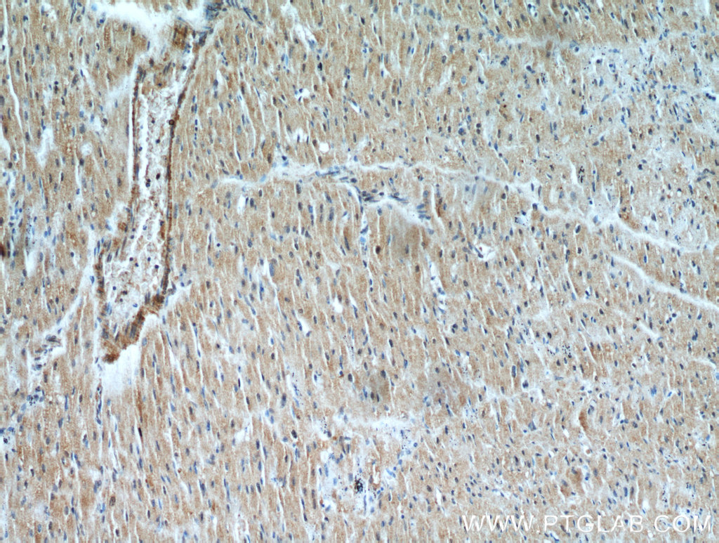 IHC staining of human heart using 21310-1-AP