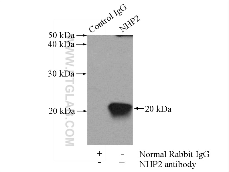 IP experiment of HepG2 using 15128-1-AP