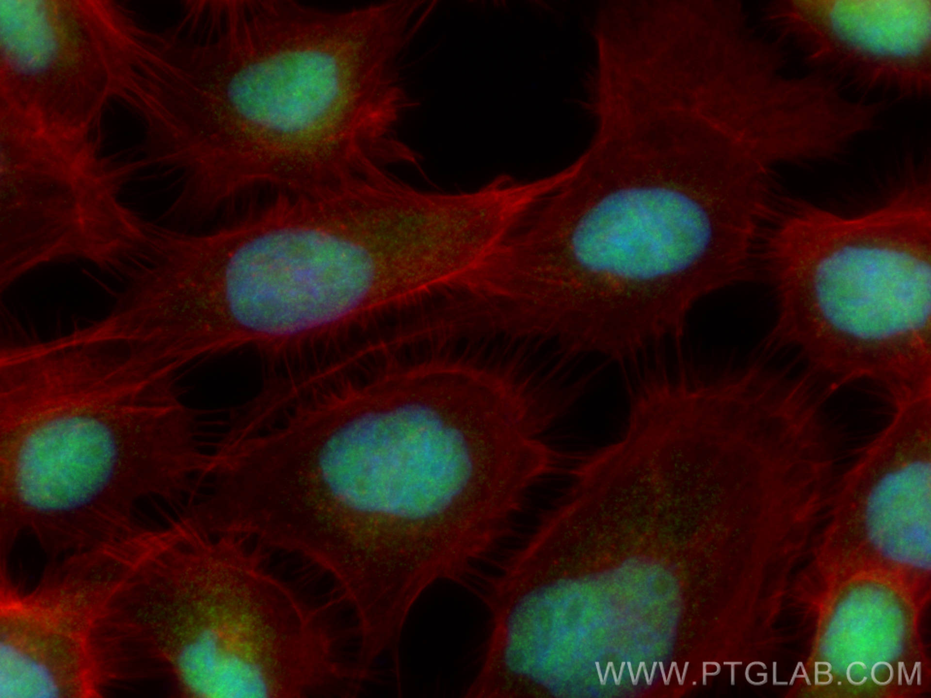 IF Staining of A431 using 15802-1-AP