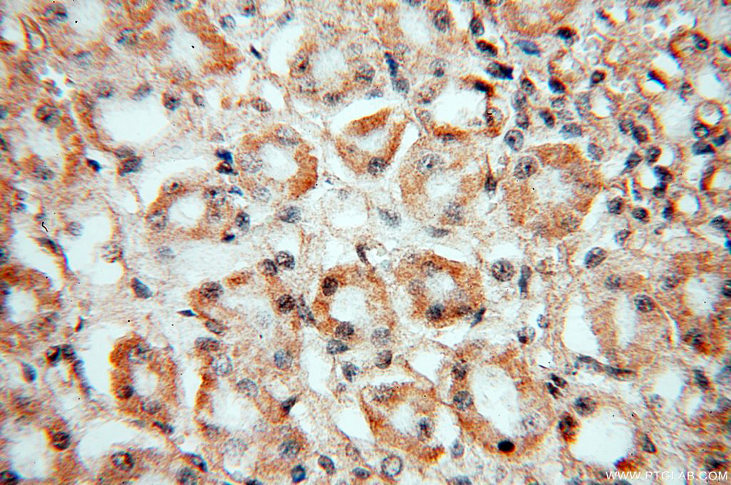 IHC staining of human kidney using 13530-1-AP
