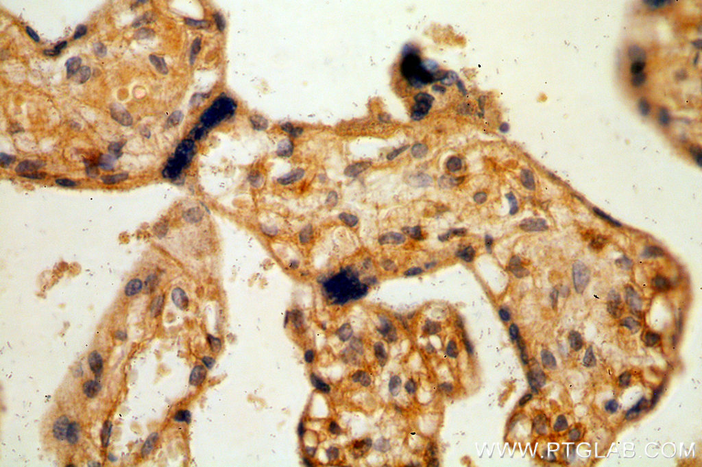 IHC staining of human placenta using 19076-1-AP