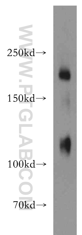 WB analysis of human placenta using 19076-1-AP