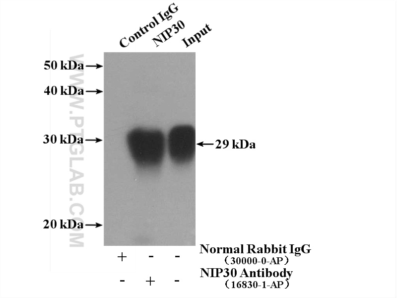 IP experiment of HeLa using 16830-1-AP