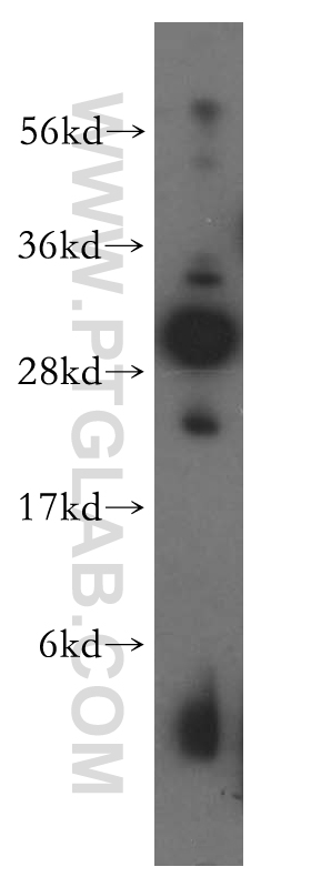 WB analysis of HeLa using 16830-1-AP