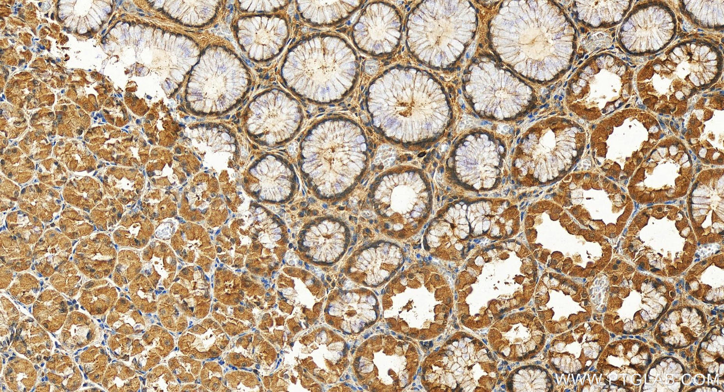 IHC staining of human stomach using 13813-1-AP