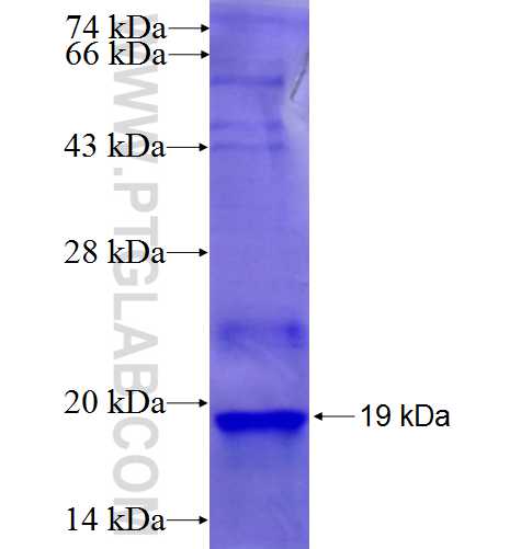 NKAP fusion protein Ag26754 SDS-PAGE