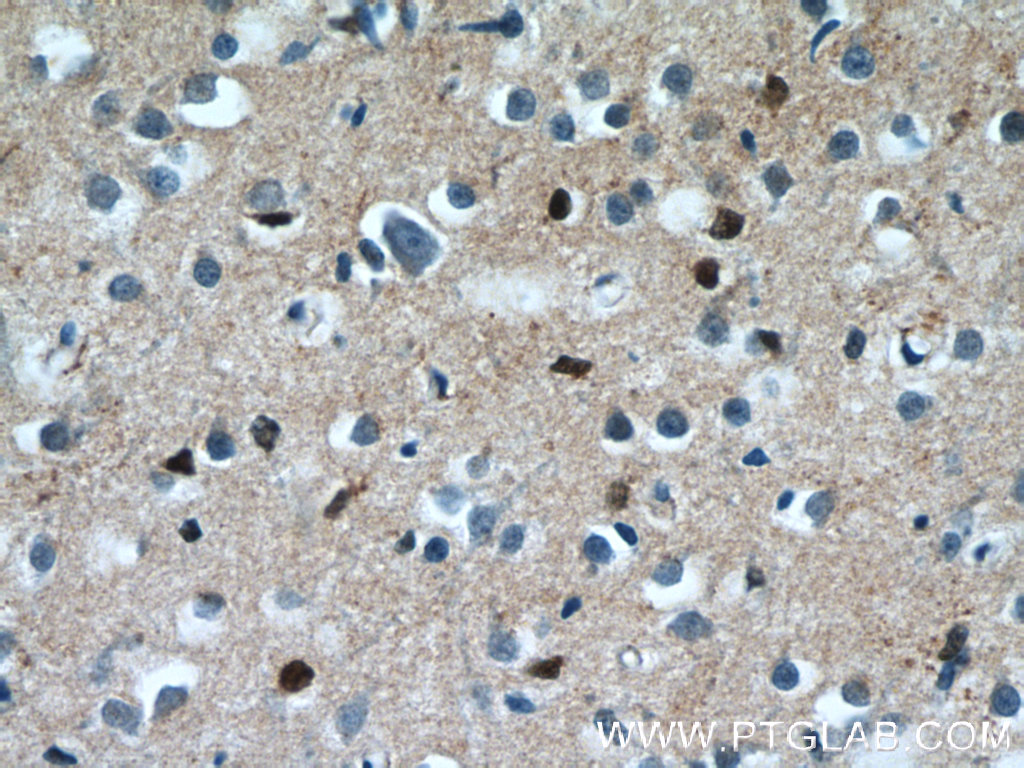 IHC staining of human brain using 55484-1-AP