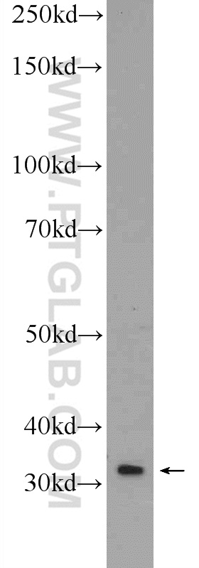 WB analysis of SH-SY5Y using 55484-1-AP