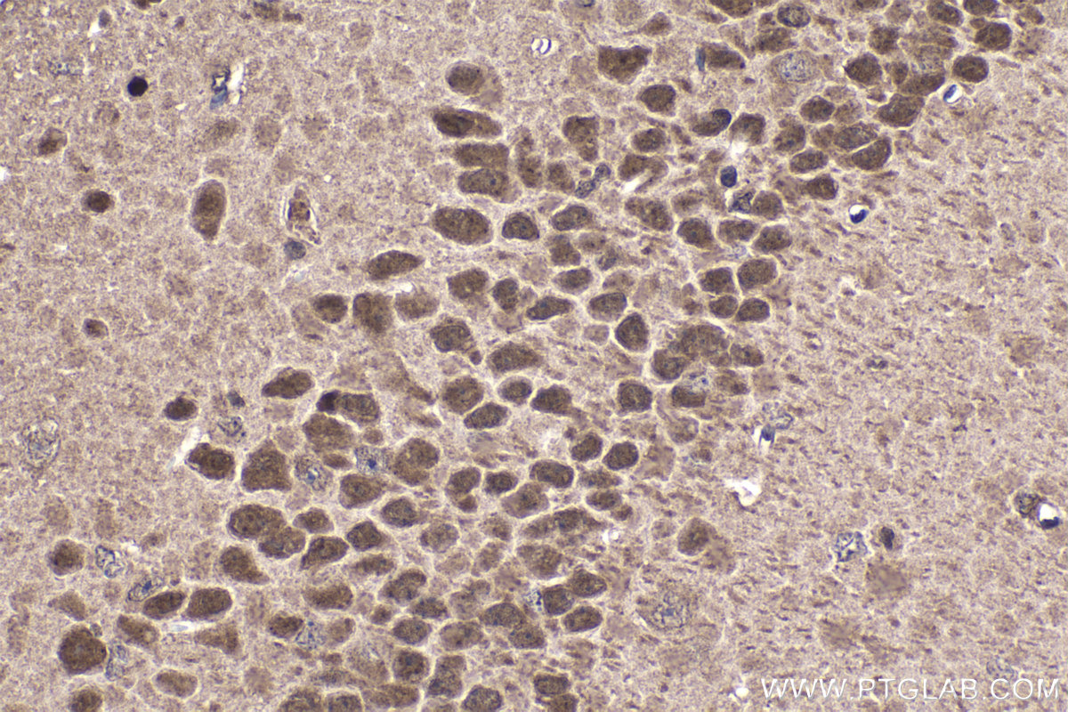 IHC staining of mouse brain using 13013-1-AP