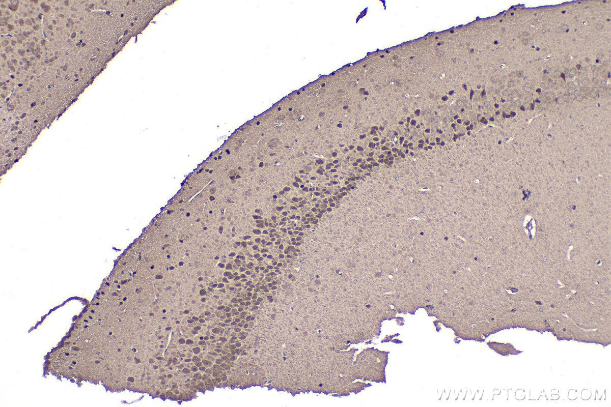 IHC staining of mouse brain using 13013-1-AP