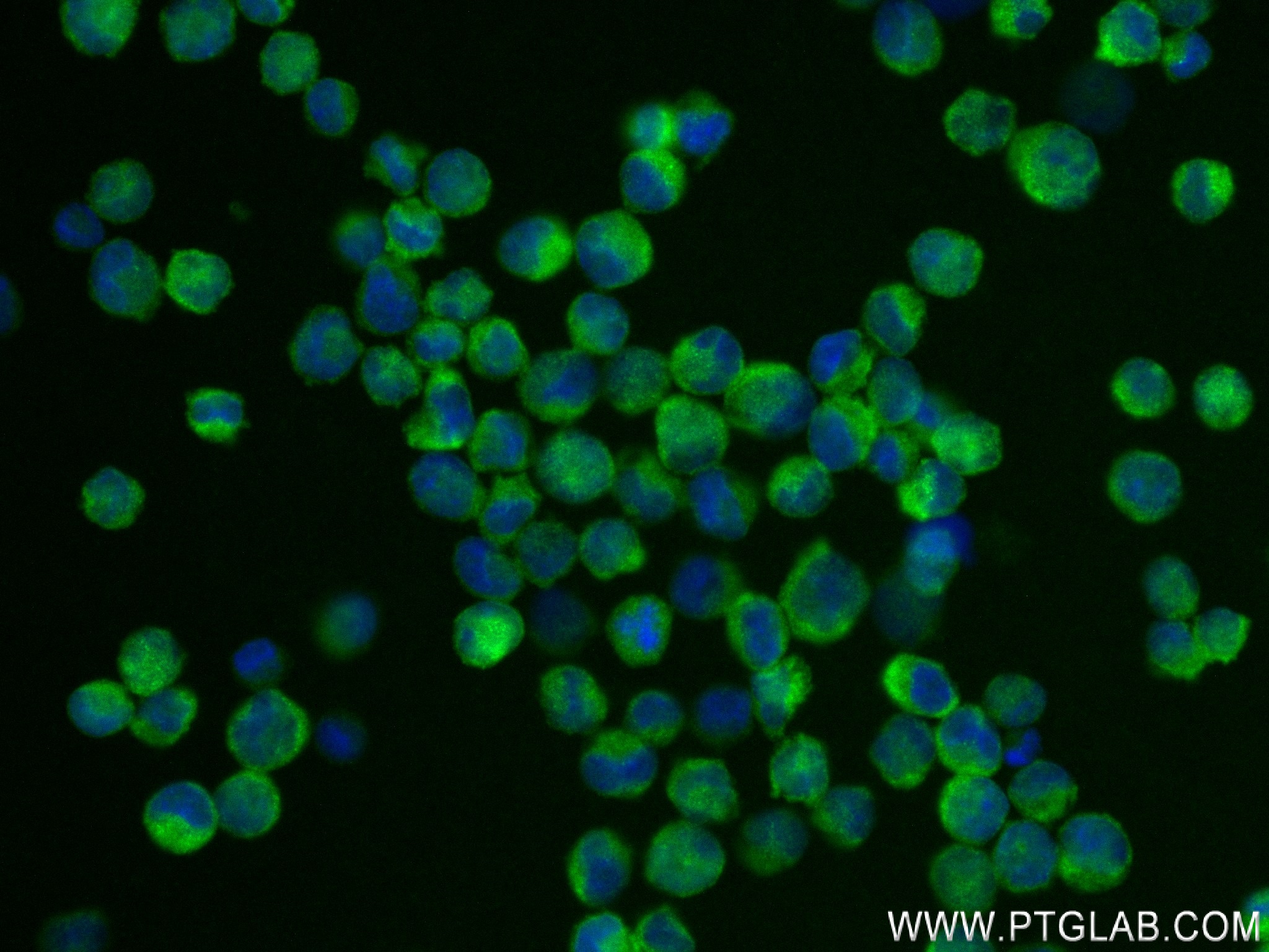 IF Staining of K-562 using 83996-4-RR