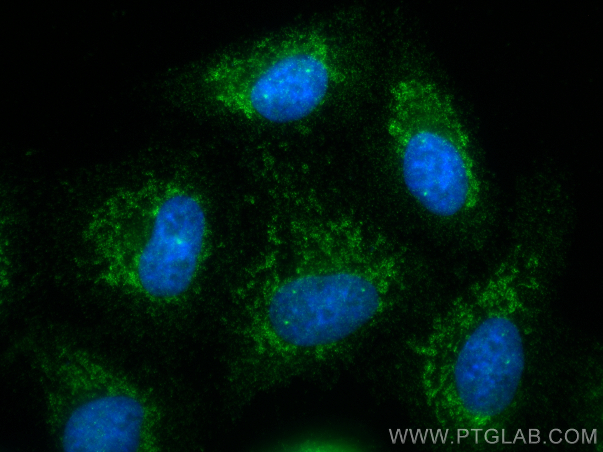 IF Staining of A549 using 17215-1-AP