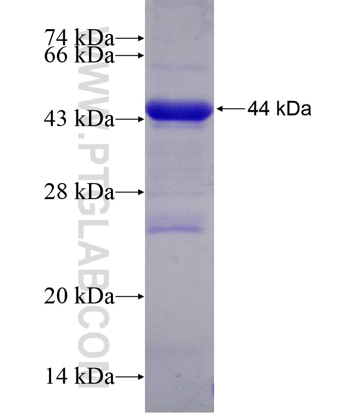 NMD3 fusion protein Ag9191 SDS-PAGE