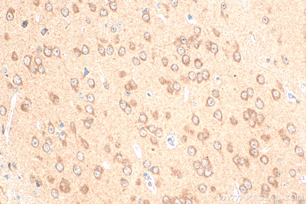 IHC staining of mouse brain using 27232-1-AP