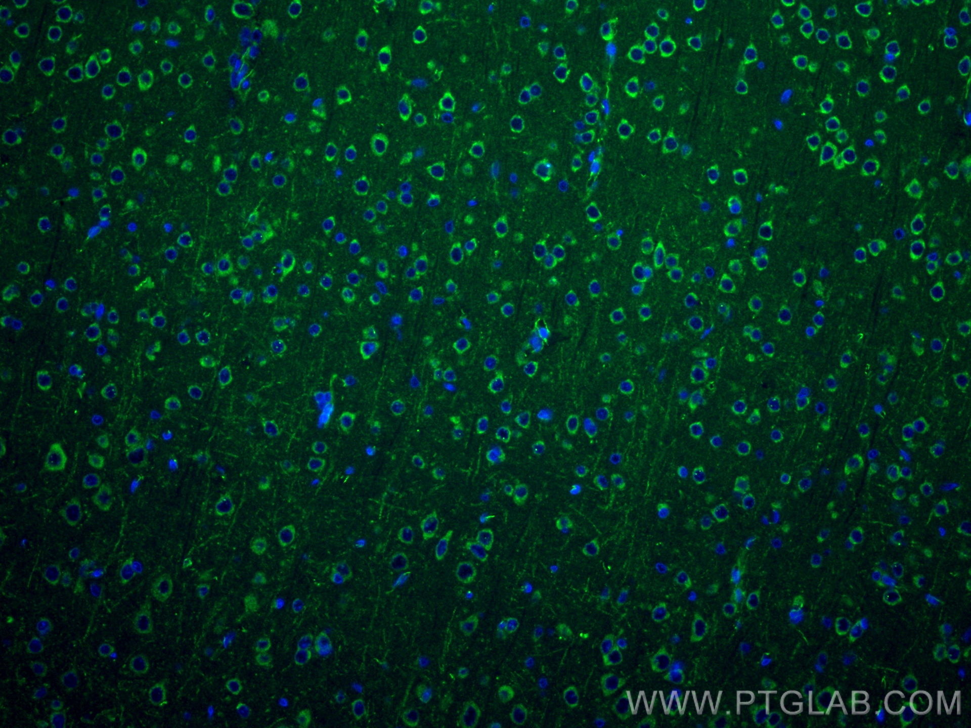 IF Staining of rat brain using 83465-2-RR (same clone as 83465-2-PBS)