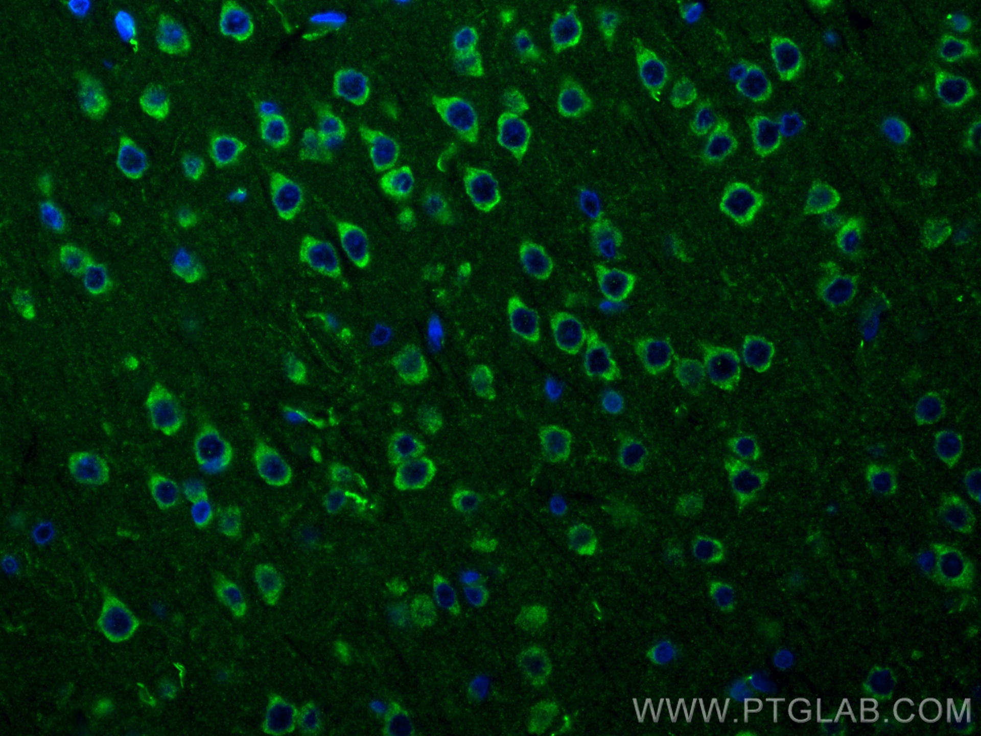 IF Staining of rat brain using 83465-2-RR (same clone as 83465-2-PBS)