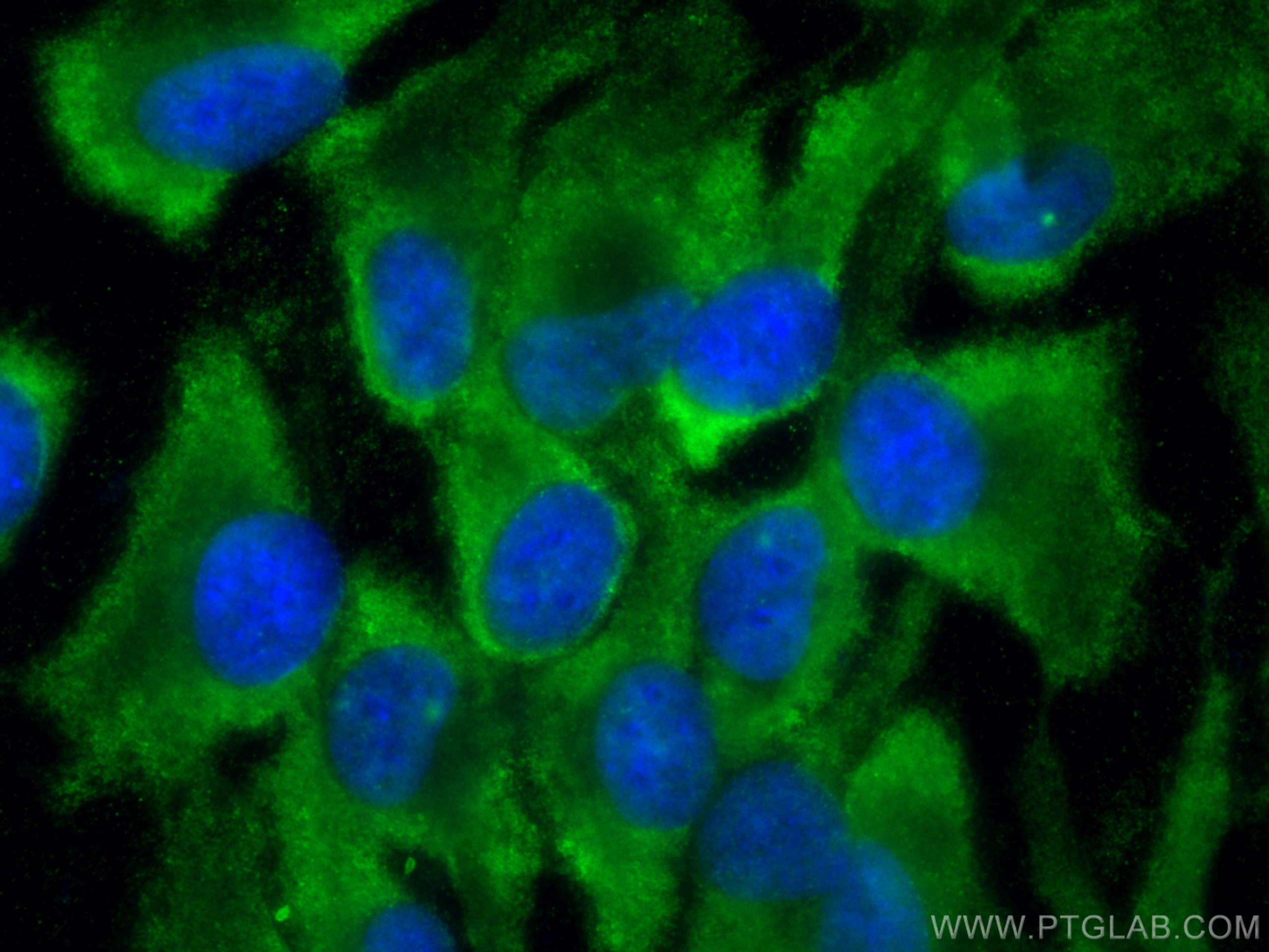 IF Staining of hTERT-RPE1 using CL488-28571