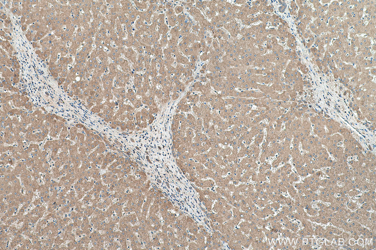 IHC staining of human liver using 11086-2-AP