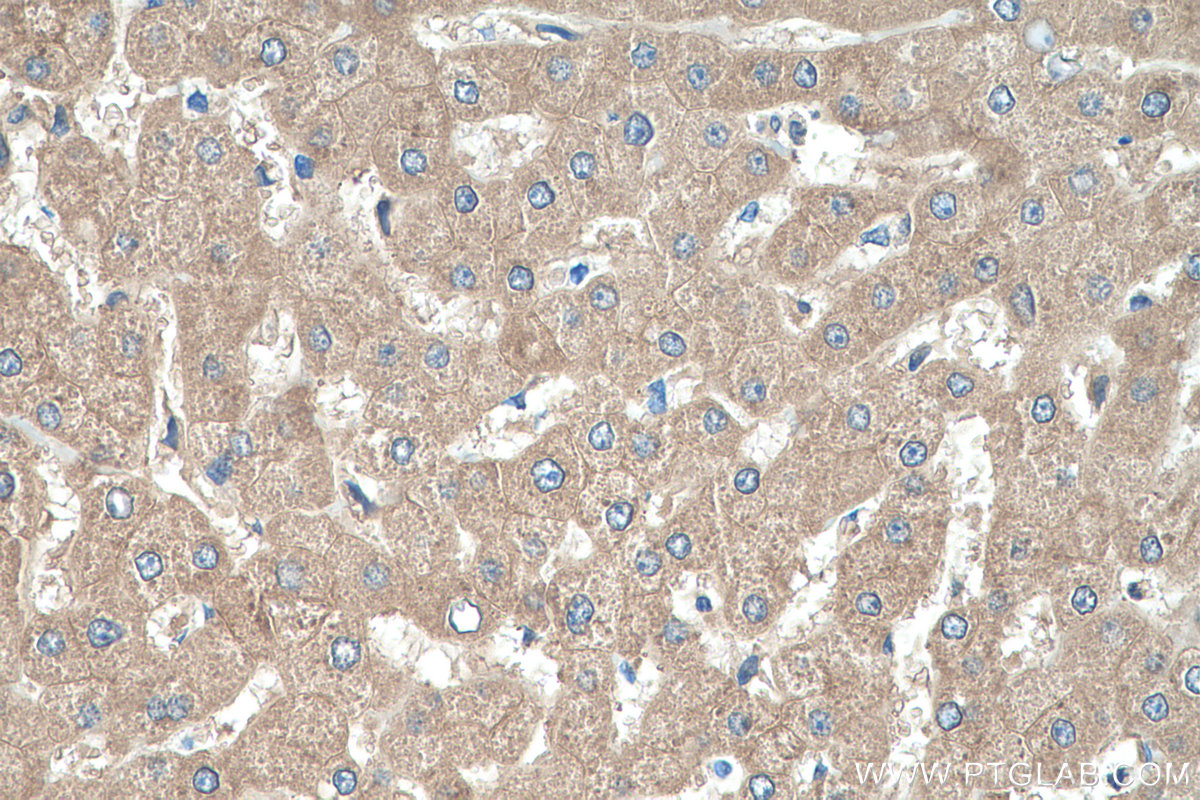 IHC staining of human liver using 11086-2-AP