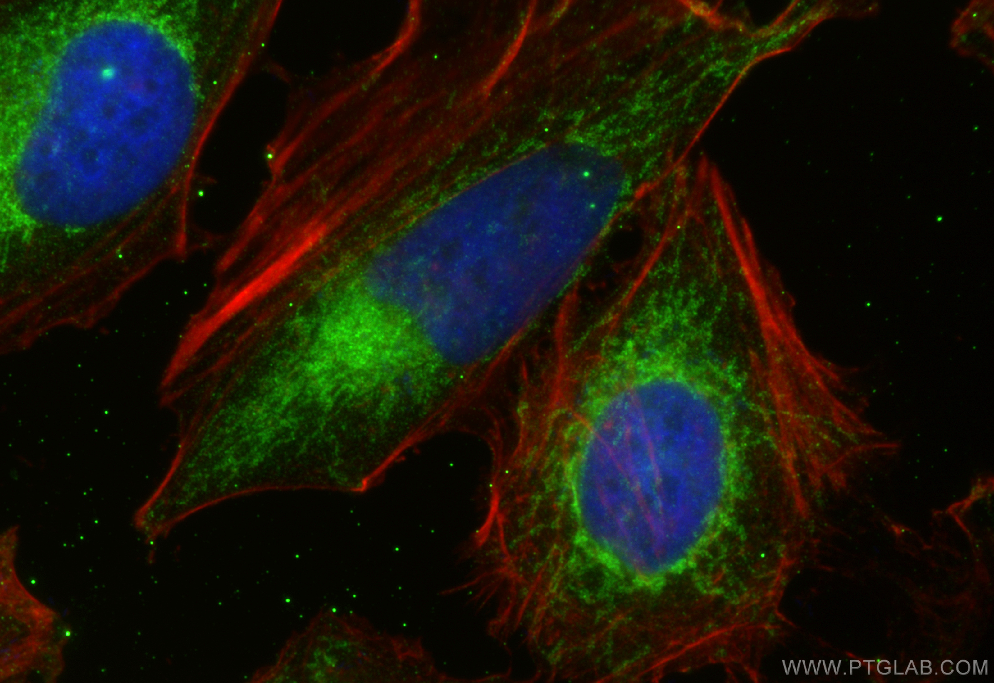 IF Staining of HeLa using 15136-1-AP