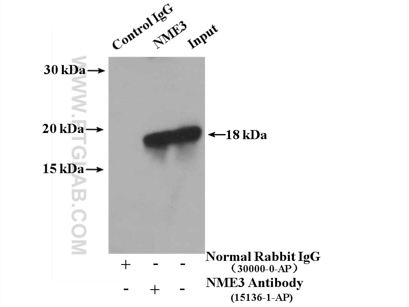 IP experiment of HEK-293 using 15136-1-AP