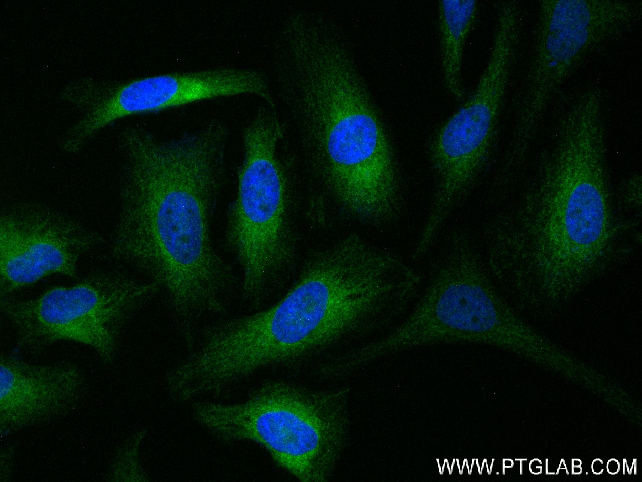 IF Staining of HeLa using 84278-5-RR