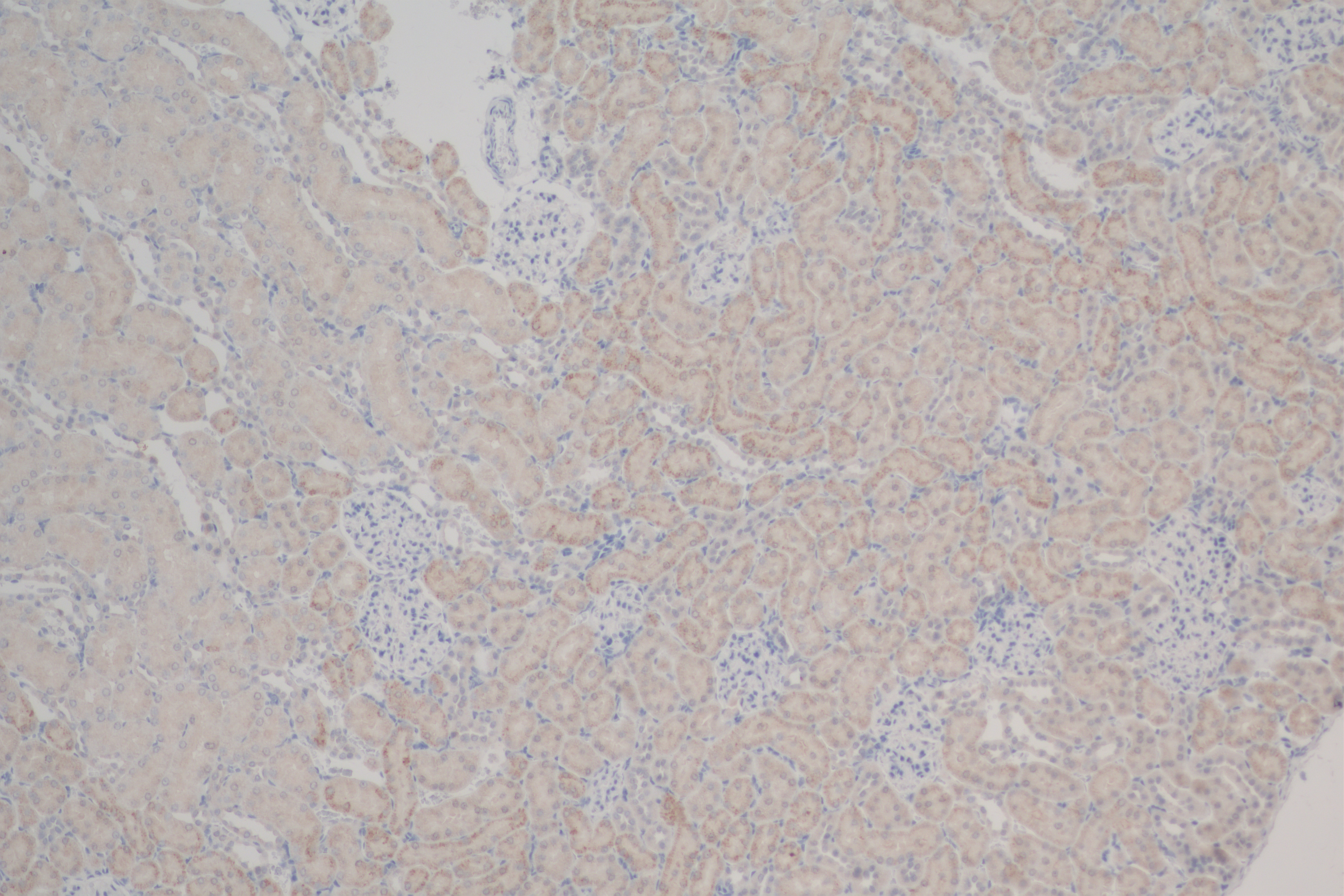 IHC staining of rat kidney using 84278-5-RR (same clone as 84278-5-PBS)