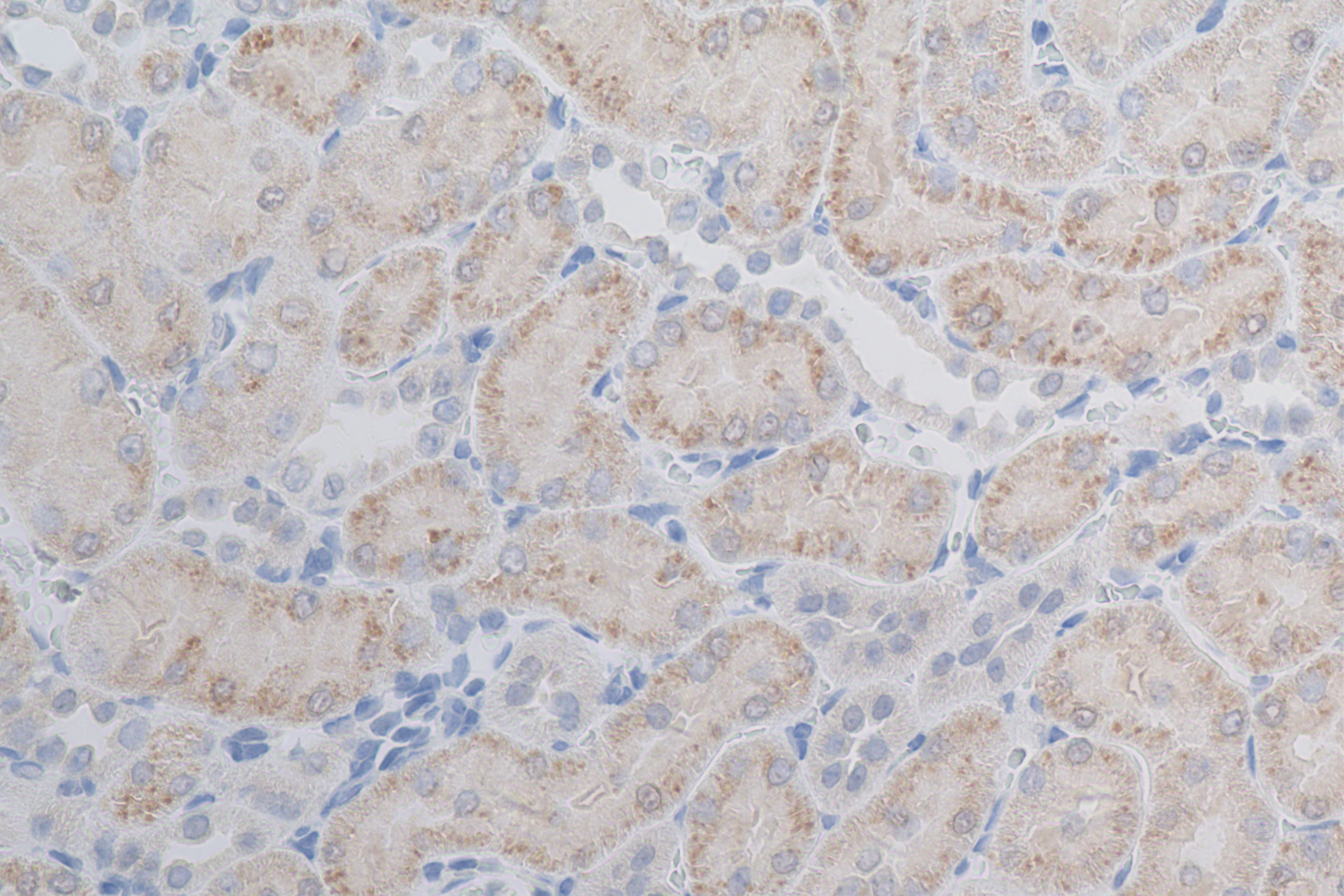 IHC staining of rat kidney using 84278-5-RR