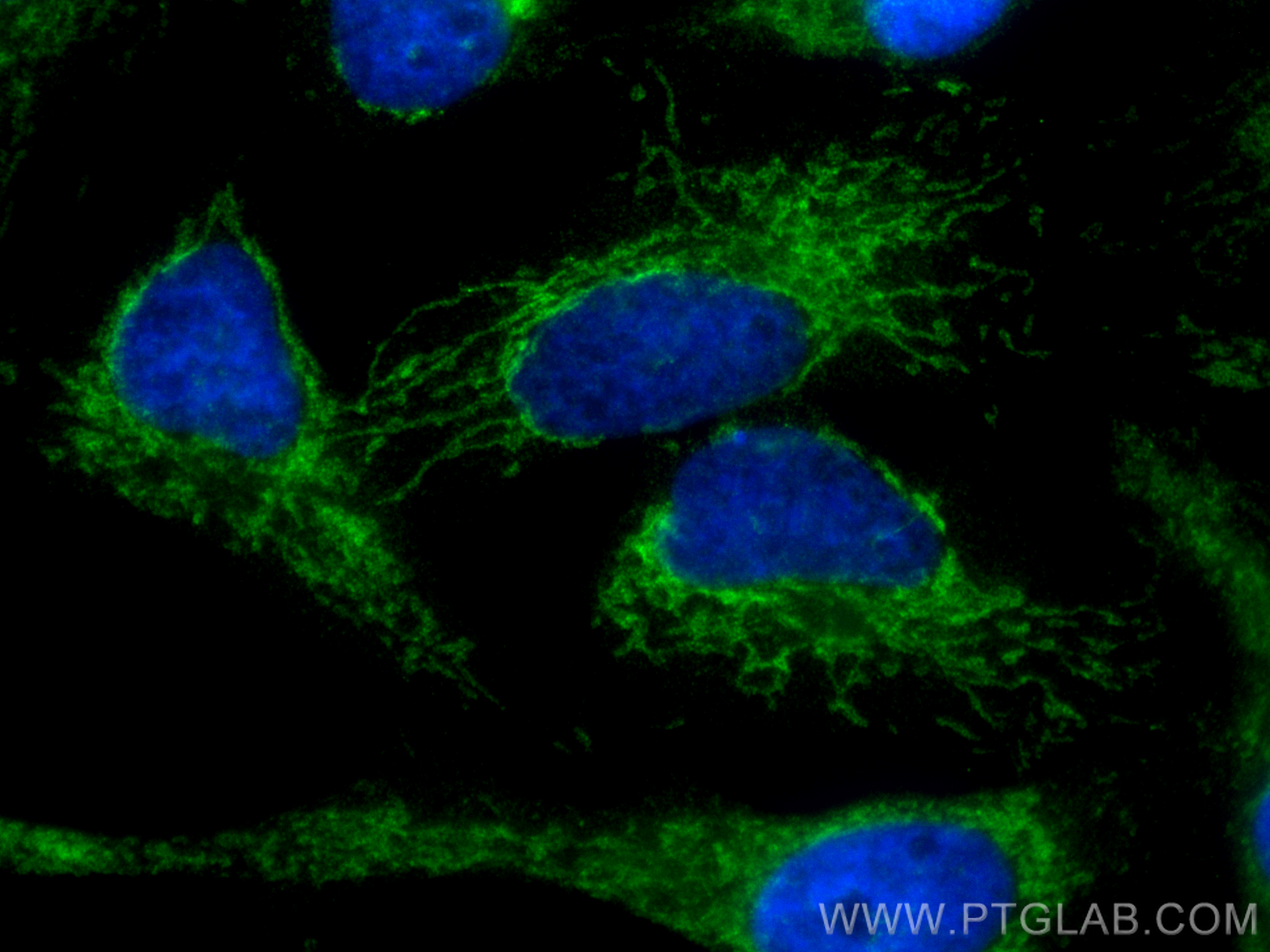 IF Staining of HeLa using CL488-84278-5