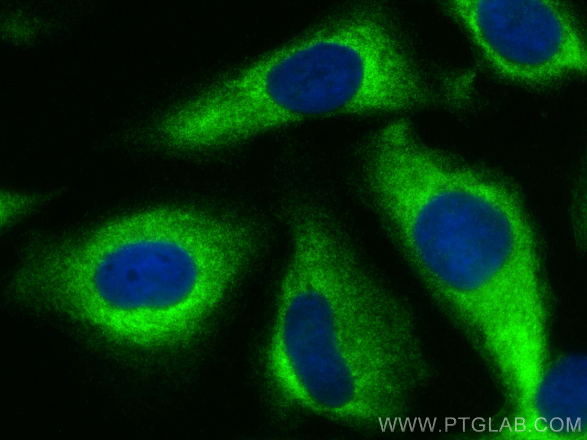 IF Staining of U2OS using 15720-1-AP