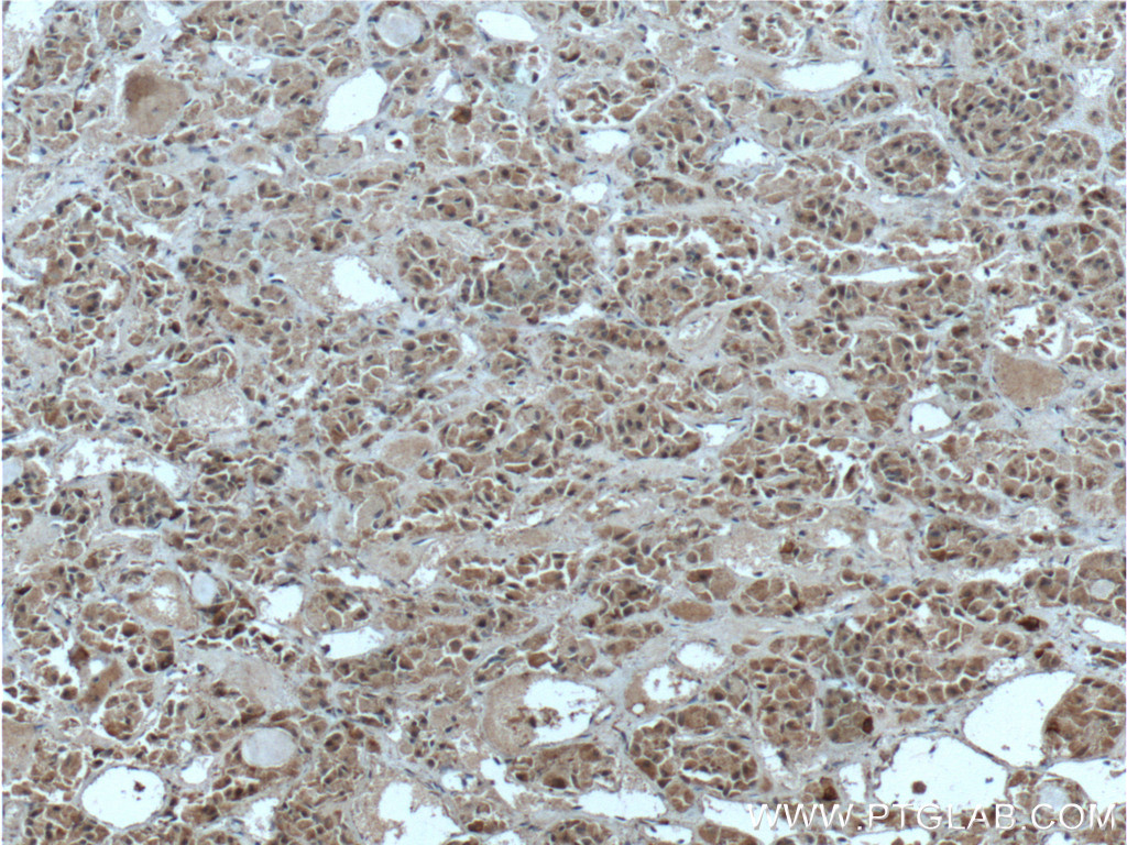 IHC staining of human pituitary using 26905-1-AP