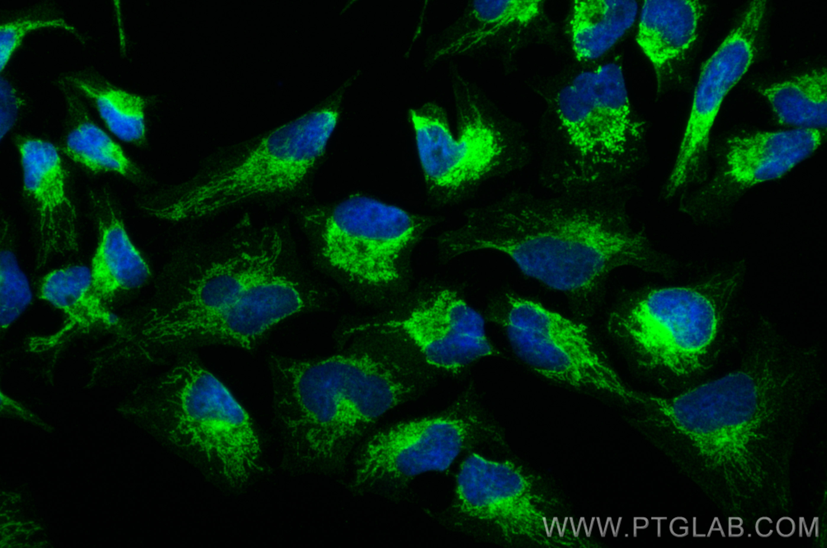 IF Staining of HeLa using 13442-2-AP