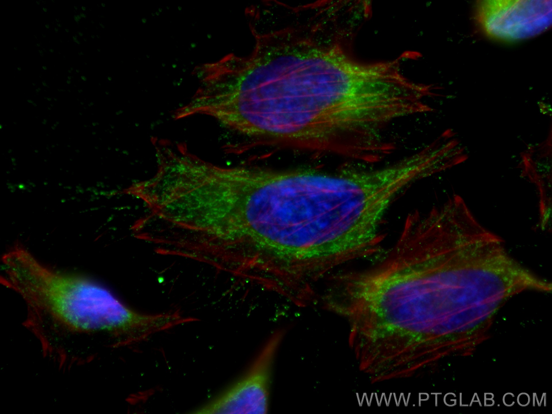 IF Staining of HeLa using 68194-1-Ig (same clone as 68194-1-PBS)