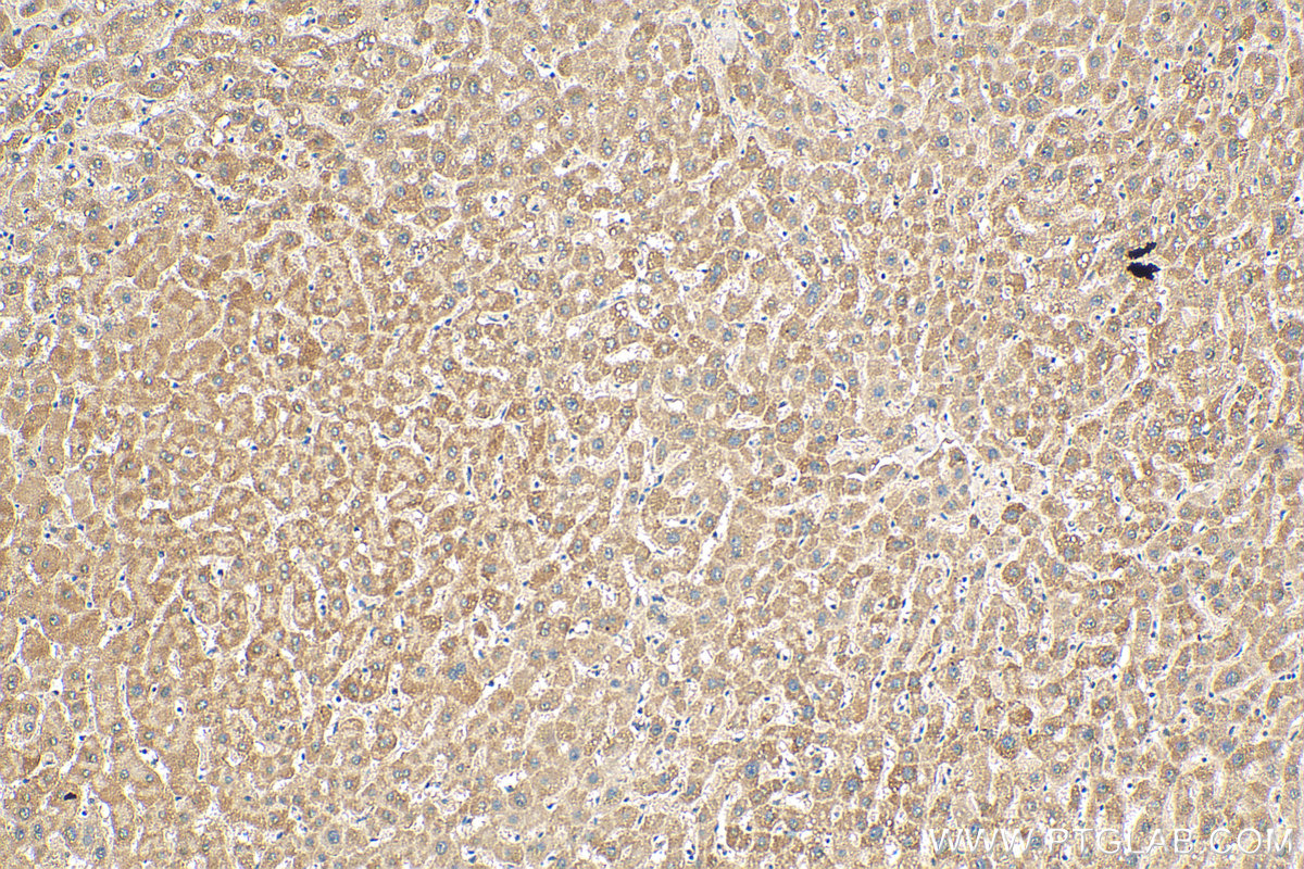 IHC staining of human liver using 68194-1-Ig (same clone as 68194-1-PBS)