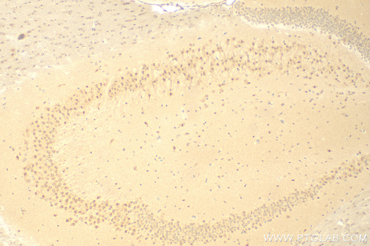 IHC staining of mouse brain using 10091-2-AP