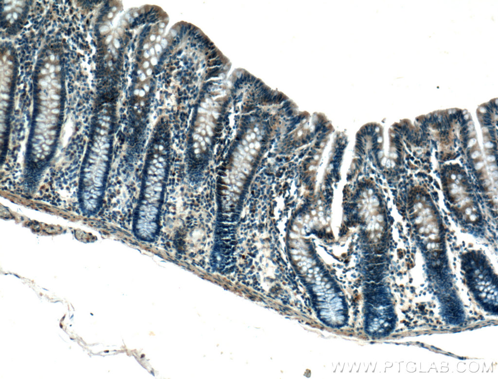 IHC staining of human colon using 20980-1-AP